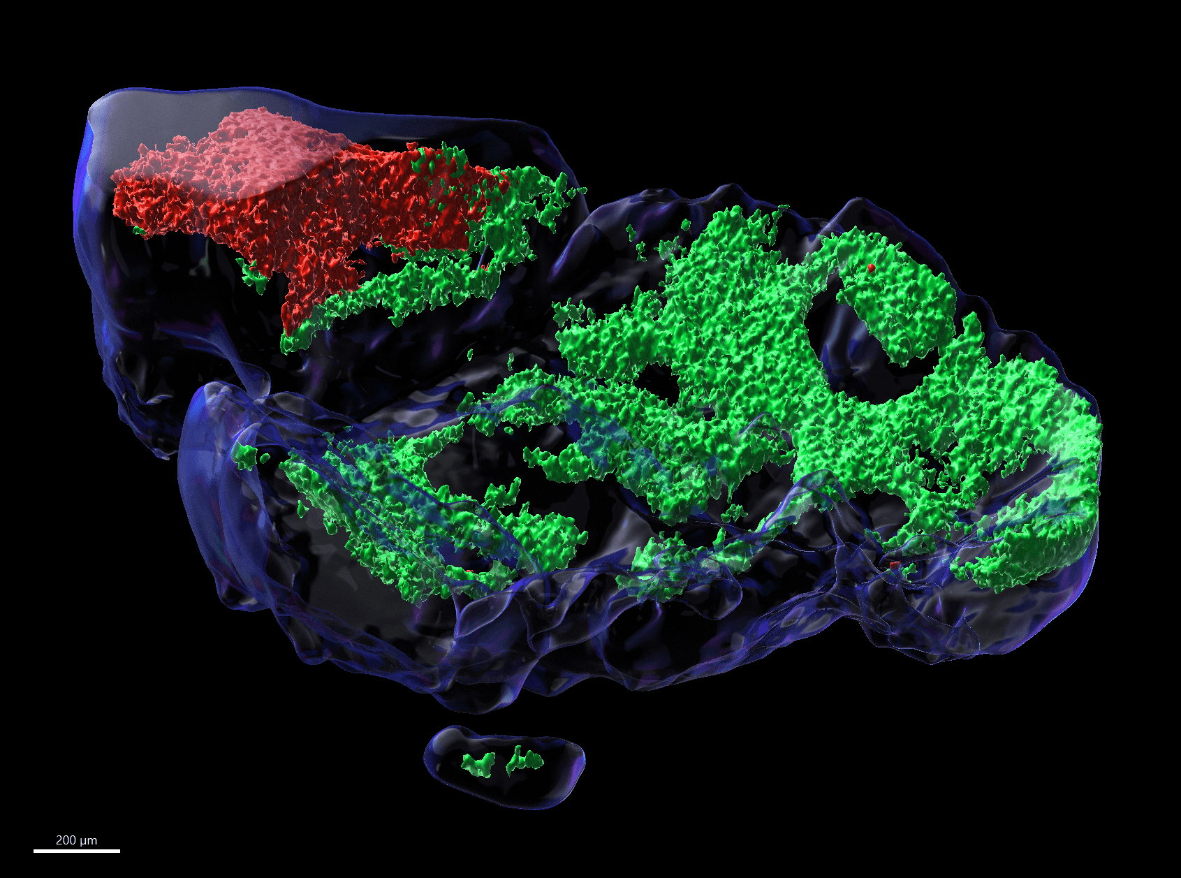 künstliche und farbige Abbildung von Tumorzellen, welche in einem Organoid gezüchtet werden