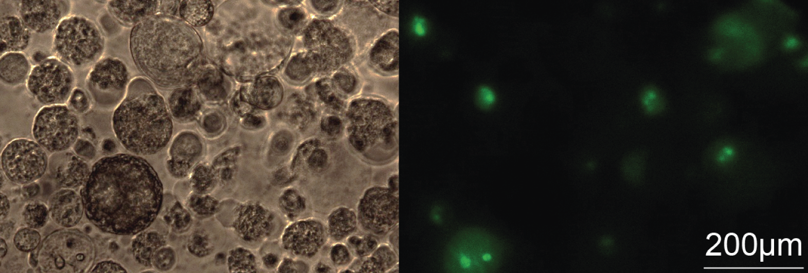 zwei Mikroskopiebilder von Lungenkrebsspheroiden